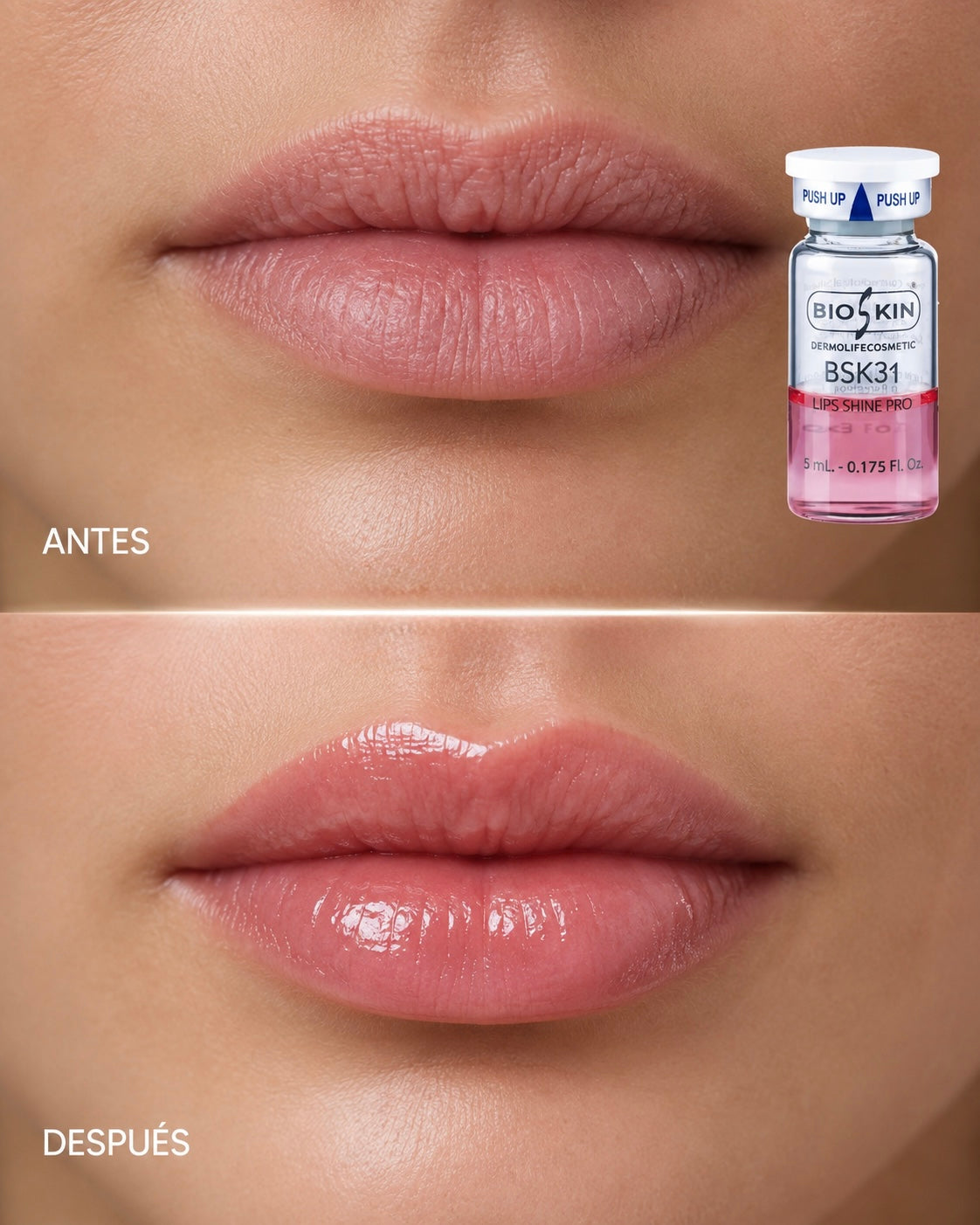 BSK31 Lips Shine Pro | Tratamiento Profesional de Volumen e Hidratación Labial