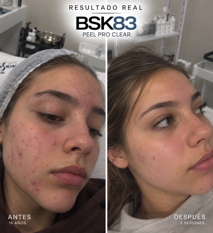 GAMA PEELPRO BIOSKIN | PEELINGS QUÍMICOS PROFESIONALES · 50 ml