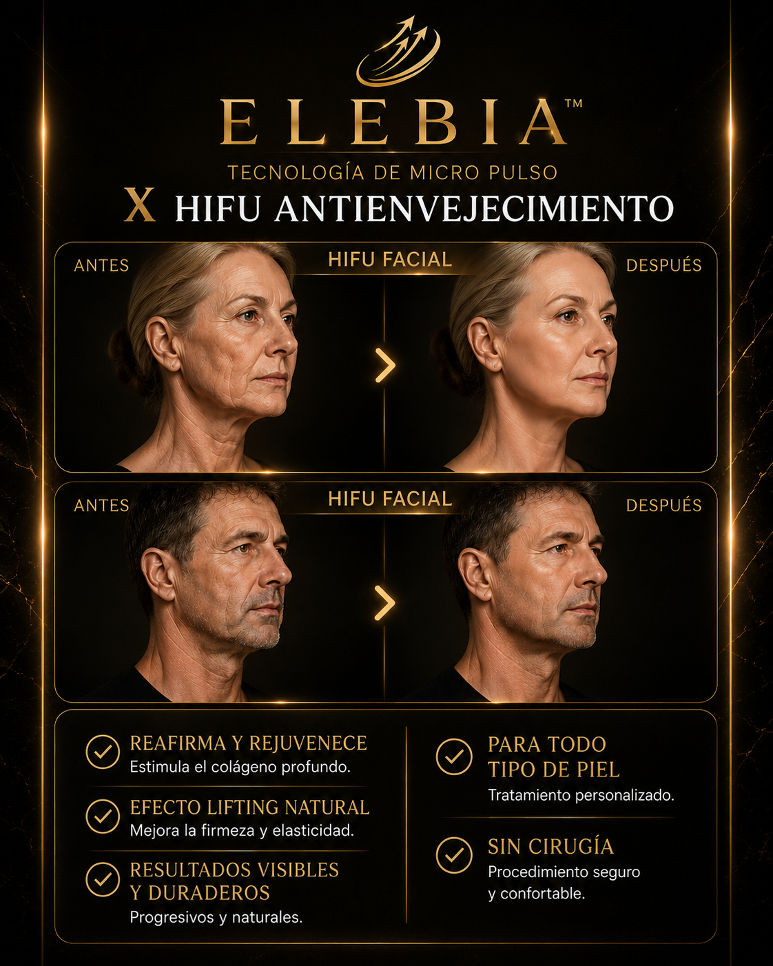 ELEBIA HIFU PROFESIONAL