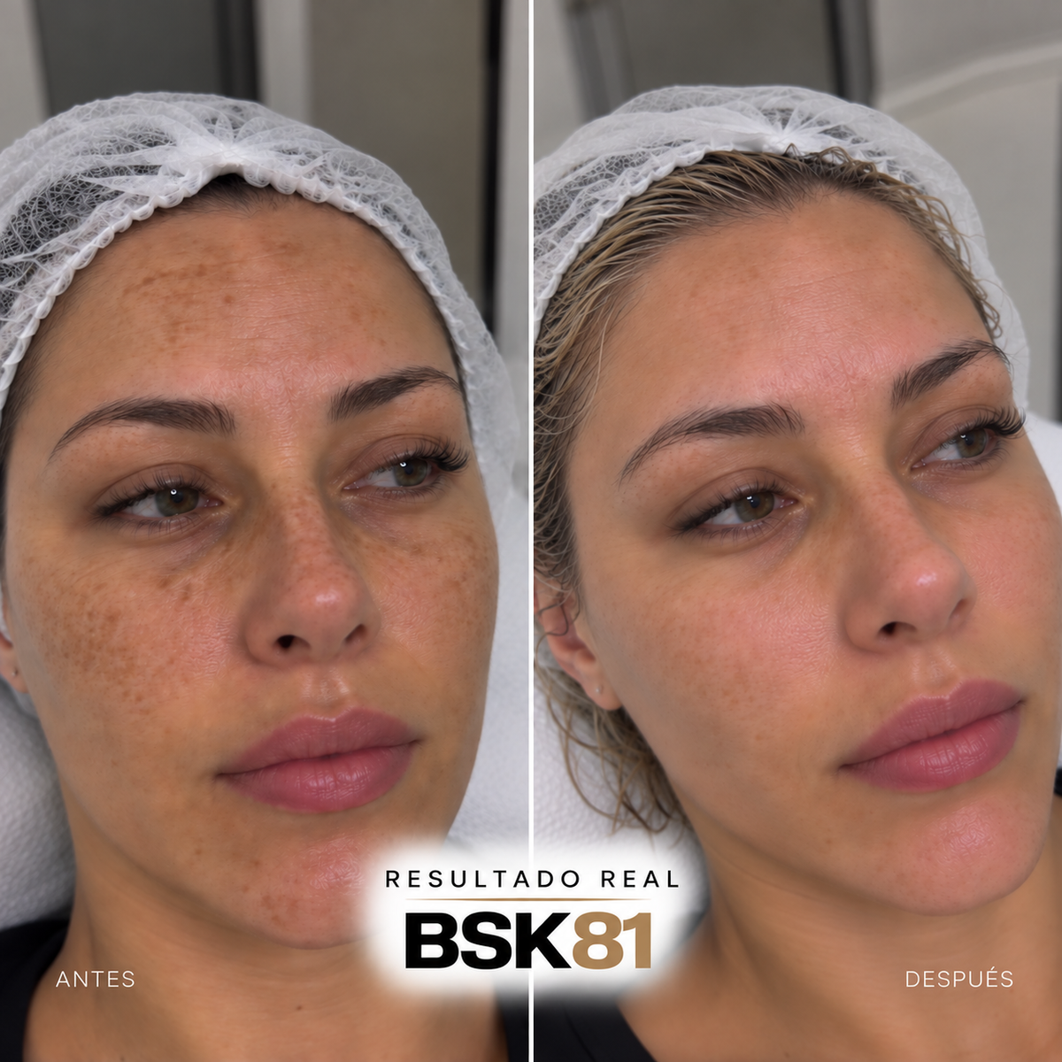GAMA PEELPRO BIOSKIN | PEELINGS QUÍMICOS PROFESIONALES · 50 ml