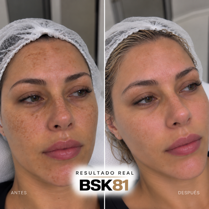 GAMA PEELPRO BIOSKIN | PEELINGS QUÍMICOS PROFESIONALES · 50 ml