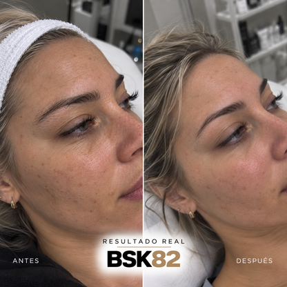 GAMA PEELPRO BIOSKIN | PEELINGS QUÍMICOS PROFESIONALES · 50 ml