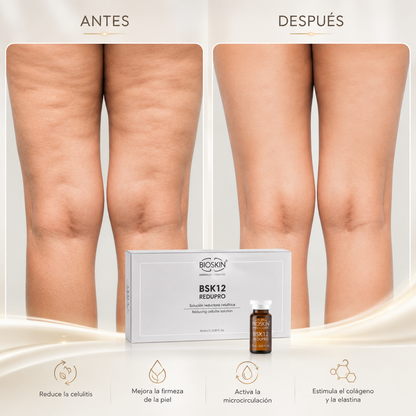 BSK12 Redupro | Tratamiento Profesional Reductor de grasa localizada, celulitis y reafirmante corporal y facial