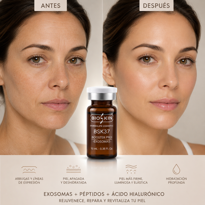 BSK37 Booster Pro Exosomas | Tratamiento Profesional Rejuvenecedor con Exosomas y Péptidos