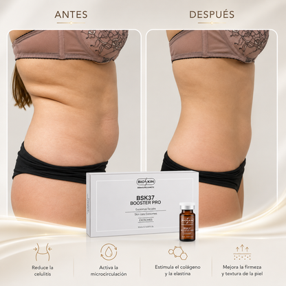 BSK12 Redupro | Tratamiento Profesional Reductor de grasa localizada, celulitis y reafirmante corporal y facial