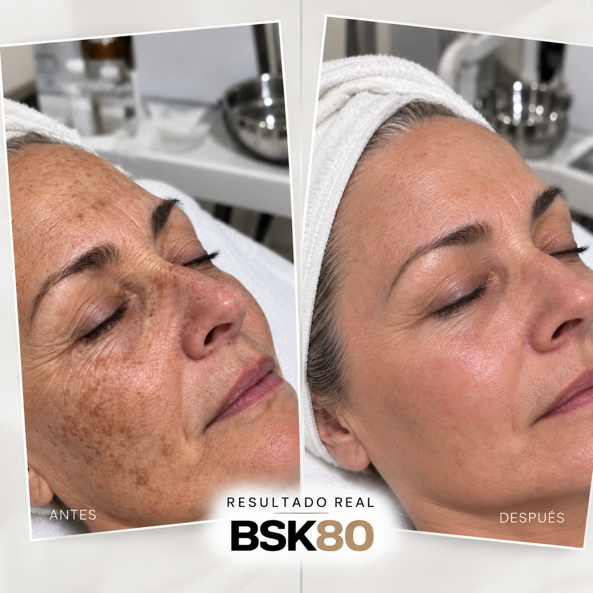 GAMA PEELPRO BIOSKIN | PEELINGS QUÍMICOS PROFESIONALES · 50 ml