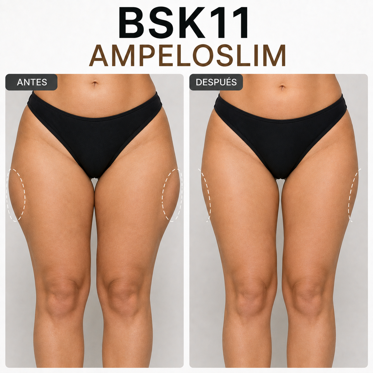 BSK11 AMPELOSLIM | Tratamiento reductor para grasa localizada y remodelación corporal