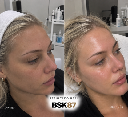 GAMA PEELPRO BIOSKIN | PEELINGS QUÍMICOS PROFESIONALES · 50 ml