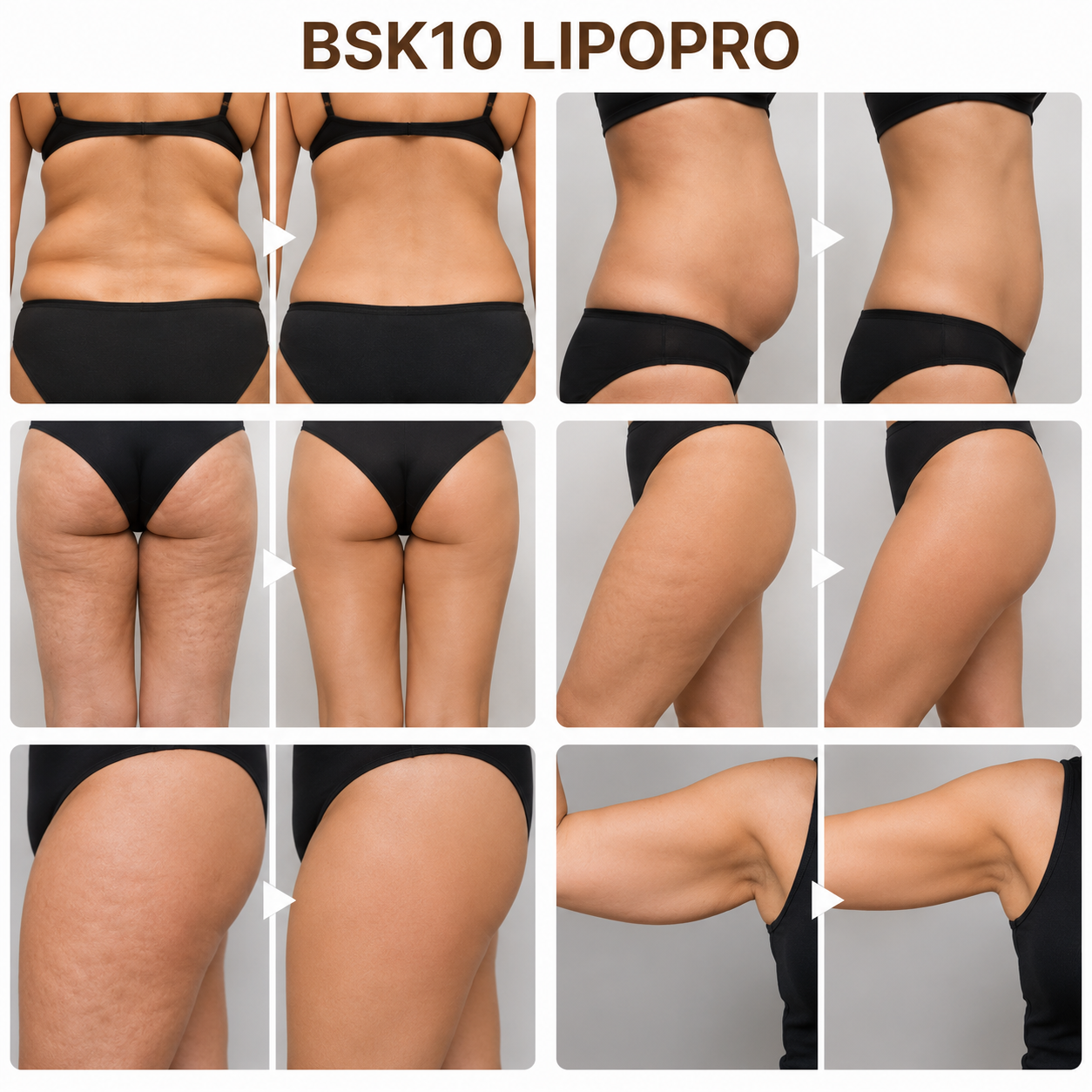BSK10 LIPOPRO | Tratamiento corporal lipolítico para grasa localizada y remodelación