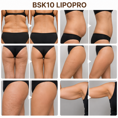 BSK10 LIPOPRO | Tratamiento corporal lipolítico para grasa localizada y remodelación