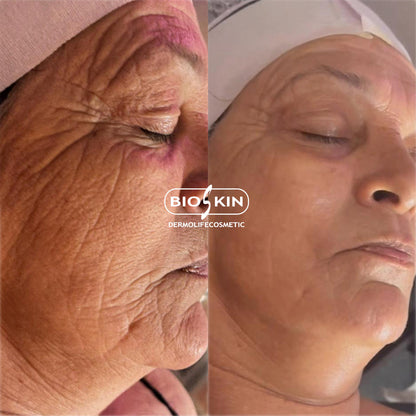 BSK13 AGEPRO | Tratamiento Profesional Reestructurante, Reafirmante e Hidratante